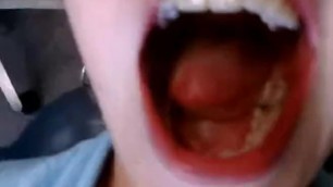 Dentist Drills Hole in Beautiful Girls Teeth, Camera Zooms to Hole in Tooth
