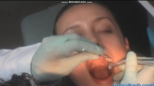 Dentist Drilling Brunette's Teeth